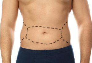Man with markings on his stomach