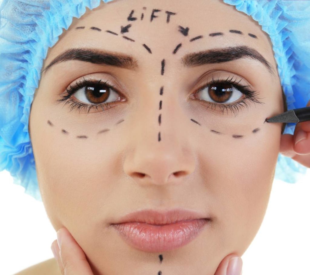 Brow Lift Recovery Charlotte, NC