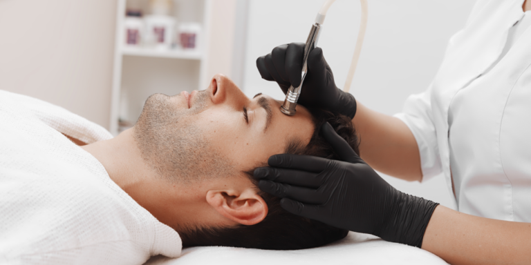 male microdermabrasion
