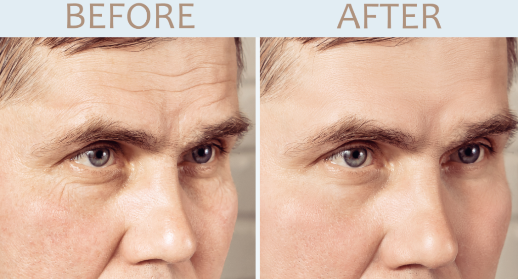 male injectables